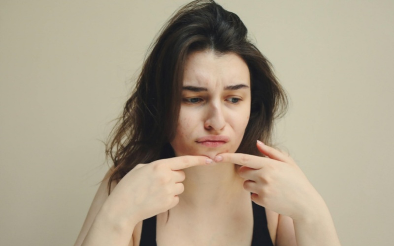 【莱沃医疗:知识分享】关于痘印修复,90%的人都做错了