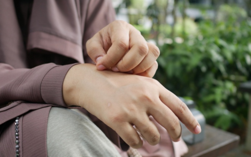 【Laiwo Medical: Knowledge Sharing】Don't let the small mosquito marks trap your summer